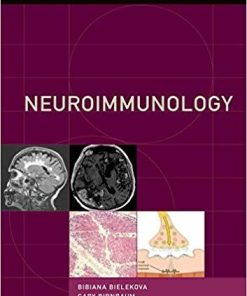 Neuroimmunology (Contemporary Neurology Series) 1st Edition