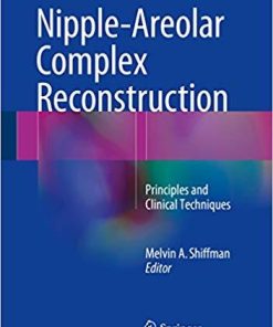 Nipple-Areolar Complex Reconstruction: Principles and Clinical Techniques 1st ed. 2018 Edition