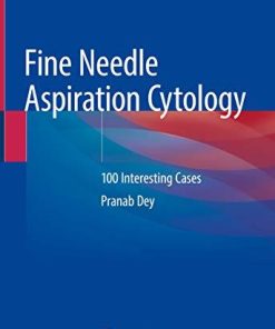 Fine Needle Aspiration Cytology: 100 Interesting Cases 1st ed. 2020 Edition