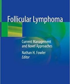 Follicular Lymphoma: Current Management and Novel Approaches 1st ed. 2020 Edition