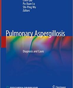 Pulmonary Aspergillosis: Diagnosis and Cases 1st ed. 2019 Edition