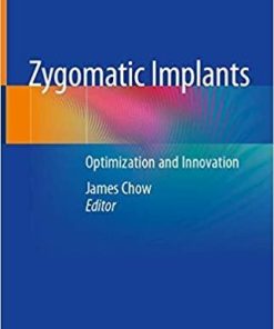 Zygomatic Implants: Optimization and Innovation 1st ed. 2020 Edition