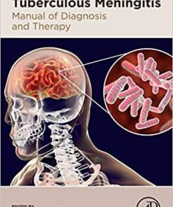 Tuberculous Meningitis: Manual of Diagnosis and Therapy 1st Edition