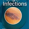 Handbook of Fungal Infections (PDF)