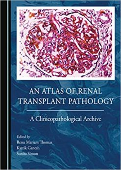 An Atlas of Renal Transplant Pathology