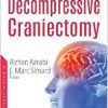 Decompressive Craniectomy (PDF)