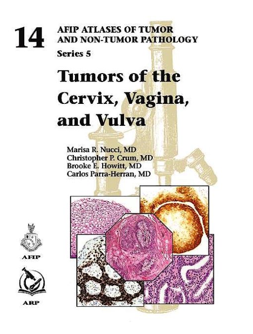 Tumors of the Cervix