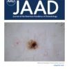 Journal of the American Academy of Dermatology PDF