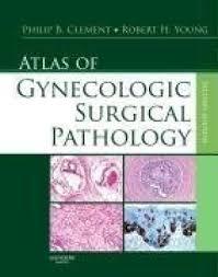 Atlas of Gynecologic Surgical Pathology, 2e