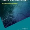 Controversies in Neuro-Ophthalmology