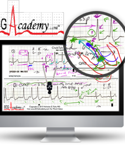 ECG Academy: Advanced Level Video Lecture Course-Videos