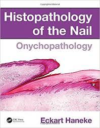 Histopathology of the Nail: Onychopathology 1st