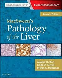 MacSween’s Pathology of the Liver E-Book 7th