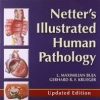 Netter’s Illustrated Human Pathology Updated Edition: with Student Consult Access, 1e