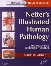 Netter’s Illustrated Human Pathology Updated Edition: with Student Consult Access, 1e