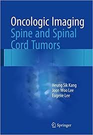 Oncologic Imaging: Spine and Spinal Cord Tumors 1st ed