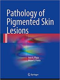 Pathology of Pigmented Skin Lesions 1st