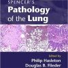 Spencer’s Pathology of the Lung 2 Part Set with DVDs 6th Edition