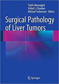 Surgical Pathology of Liver Tumors 1st ed. 2015 Edition