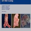 Thurlbeck’s Pathology of the Lung 3rd edition Edition