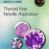 Thyroid Fine Needle Aspiration