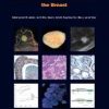 WHO Classification of Tumours of the Breast (IARC WHO Classification of Tumours)-Original PDF