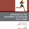 Clinics in Sports Medicine: Volume 42 (Issue 1 to Issue 2) 2023 PDF