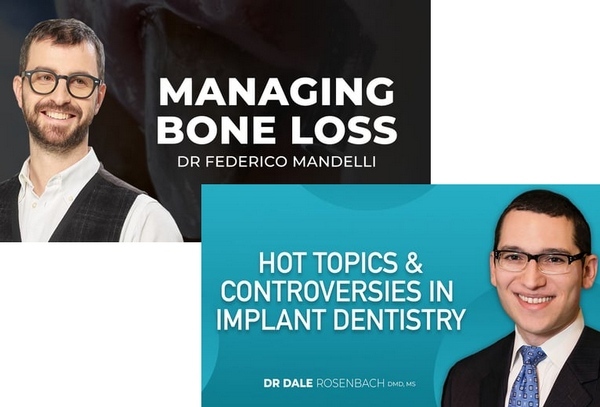 Controversies in Implant Dentistry and Managing Bone Loss