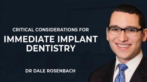 Critical Considerations for Immediate Implant Dentistry