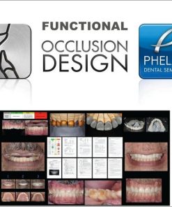 Functional Occlusion Design Dental Seminars (Full Bonus Package)