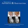 Seminars in Arthritis and Rheumatism: Volume 52 to Volume 57 2022 PDF