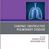 Chronic Obstructive Pulmonary Disease, An Issue of Clinics in Chest Medicine (Volume 41-3) (The Clinics: Internal Medicine, Volume 41-3) (PDF)