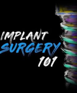 Implant Surgery 101 – Implant Ninja