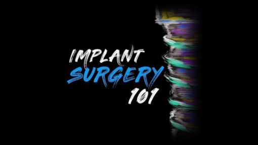 Implant Surgery 101 – Implant Ninja