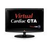 Virtual Cardiac CTA