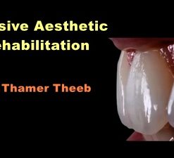 Video Dental Adhesive Aesthetic Rehabilitation (Course)