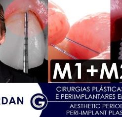 Aesthetic Periodontal and Peri-Implant Plastic Surgeries (Course)