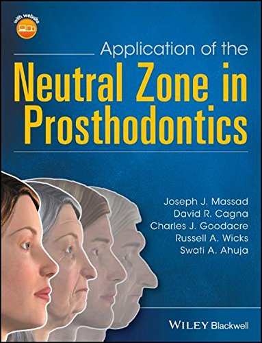 Application of the Neutral Zone in Prosthodontics (PDF Book)