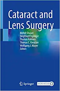 Cataract and Lens Surgery (PDF Book)