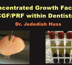 Concentrated Growth Factors: CGF/PRF within Dentistry (Video) (Course)