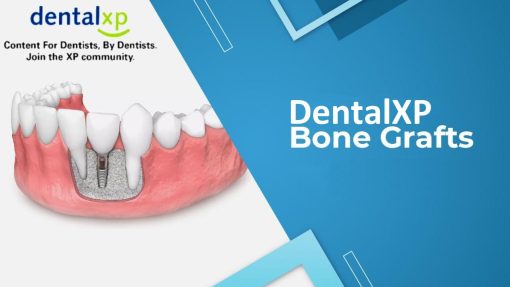 DentalXP Bone Grafts