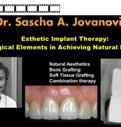 Esthetic Implant Therapy: Biological Elements in Achieving Natural Implants (Course)