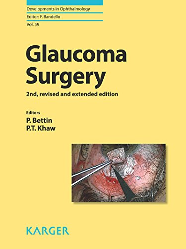 Glaucoma Surgery (Developments in Ophthalmology, Vol. 59) (PDF Book)