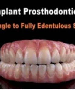 Implant Prosthodontics – From Single to Fully Edentulous Solutions (Course)