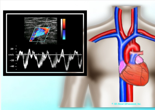 Mastering Upper Extremity Duplex – AllAboutUltrasound (HTML)