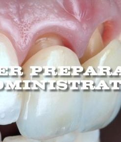 Mastery Academy Veneer Preparation and Administration – Anas Aloum (Course)