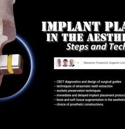 OHI-S Implant Placement in the Aesthetic Zone: Steps and Technique (Course)