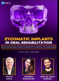 Zygomatic Implants in Oral Rehabilitation