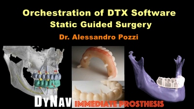 Orchestration of DTX Software