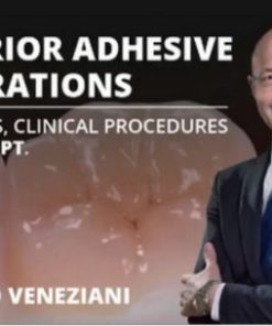 Osteocom Posterior Adhesive Restorations: Indications, Clinical Procedures and mDPT Techniques / Marco Veneziani (Course)